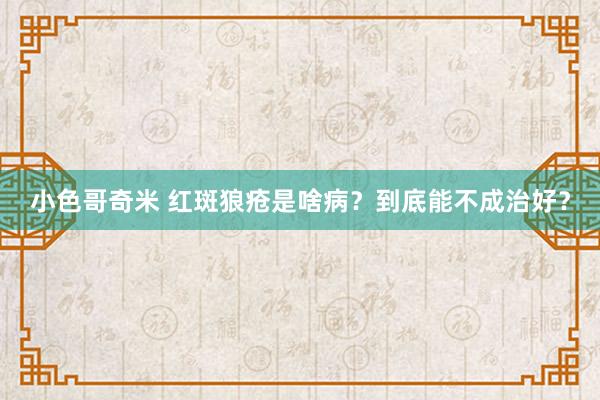 小色哥奇米 红斑狼疮是啥病？到底能不成治好？